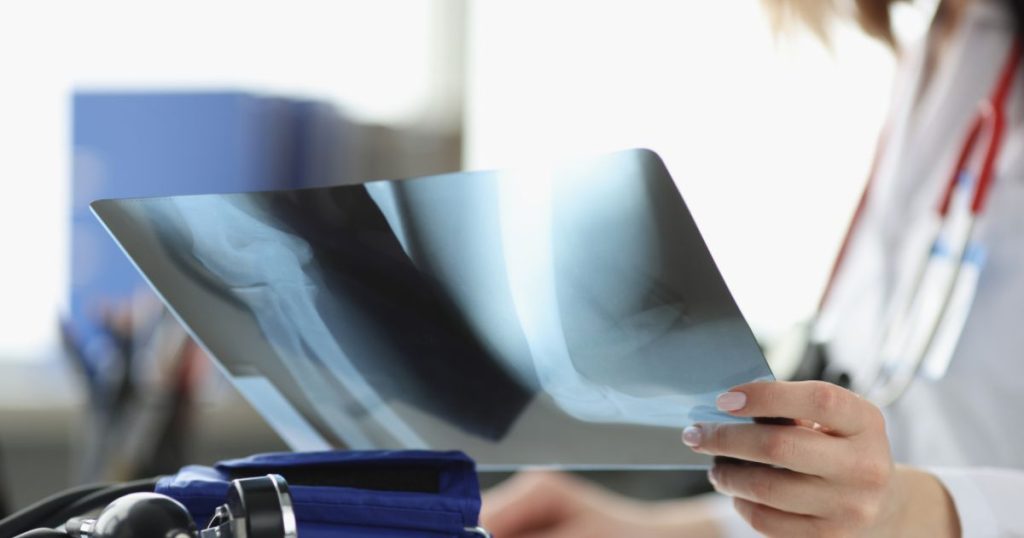 Orthopaedic surgeon looking at Xrays